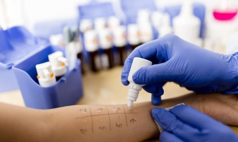 Allergy Testing for Asthma